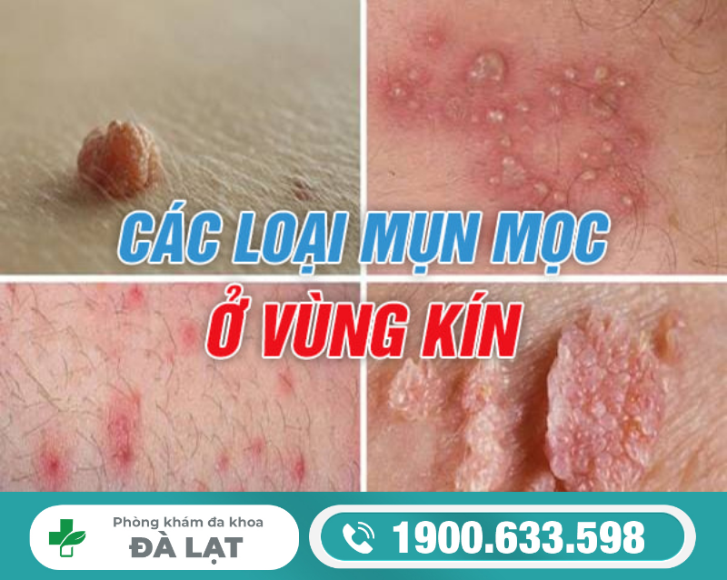 Hình ảnh minh họa